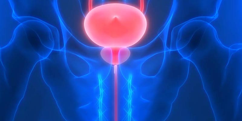Bladder Stone Specialist in Dubai